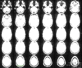 Motion-free GRAPPA images