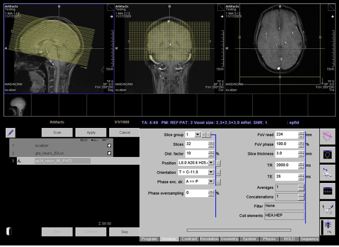 Example MPRAGE and gre_neuro_2DLoc scans